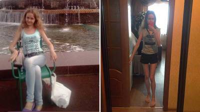 «Не могу спать и есть»: жительница Ульяновска больше года пытается восстановиться после коронавируса - russian.rt.com - Москва - Ульяновск