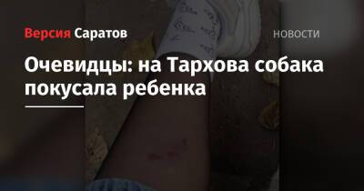 Очевидцы: на Тархова собака покусала ребенка - nversia.ru - Саратова