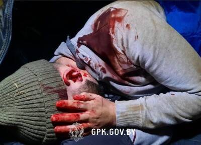 Избиты до крови: польских пограничников обвинили в насилии над беженцами - bloknot.ru - Белоруссия - Польша