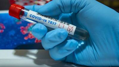 Еще 16 новосибирцев с COVID-19 умерли за минувшие сутки - runews24.ru - Новосибирская обл.