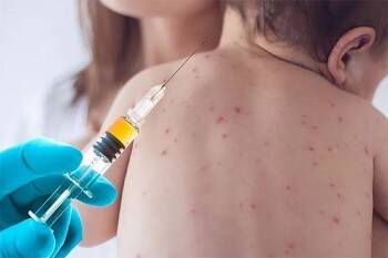 ВОЗ: Ковид может спровоцировать вспышку кори - vologda-poisk.ru