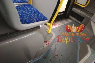 Разбитой в маршрутке головой пассажира заинтересовались следователи воронежского СК - vrn.mk.ru - Воронеж