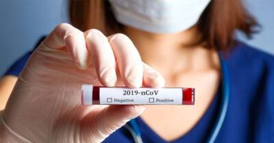 В Германии больше не берут деньги за тесты на COVID-19 - enovosty.com - Германия