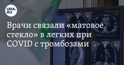 Владимир Болибок - Врачи связали «матовое стекло» в легких при COVID с тромбозами - ura.news