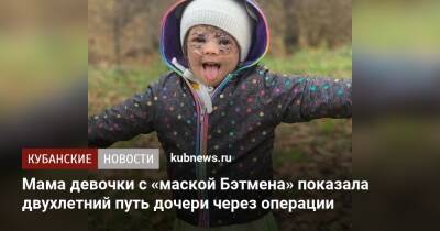 Мама девочки с «маской Бэтмена» показала двухлетний путь дочери через операции - kubnews.ru - США - Краснодар