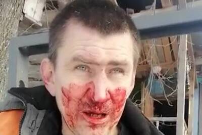 Кузбасский экоактивист рассказал, что его избили приехавшие с экс-депутатом мужчины - tayga.info - Кузбасс
