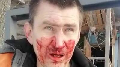 Кузбасского экоактивиста избили в присутствии бывшего депутата - svoboda.org