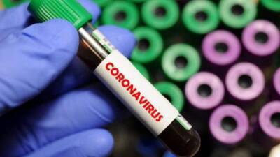 Джавид Саджид - В ЮАР обнаружен новый вариант коронавируса - hubs.ua - Украина - Англия - Гонконг - Юар - Ботсвана - Covid