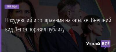 Григорий Лепс - Похудевший и со шрамами на затылке. Внешний вид Лепса поразил публику - skuke.net