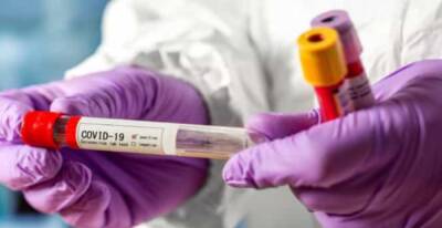 Ситуация с COVID-19 на Луганщине: свежие данные по региону - vchaspik.ua - Украина