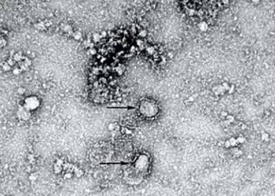 Зимняя Универсиада в Люцерне отменена из-за нового штамма коронавируса - nakanune.ru - Китай - Англия - Швейцария - Бельгия - Израиль - Австралия - Дания - Чэнд