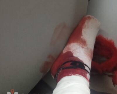 В Сосновой Поляне две девушки в ответ на замечание женщины натравили на нее собак - ivbg.ru - Украина - Санкт-Петербург - Петербург