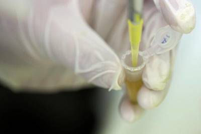 Новости биофарма: G1 Therapeutics, OraSure и Cortexyme - smartmoney.one - Reuters