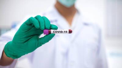 В России за сутки выявили 30 873 новых случая COVID-19 - mir24.tv - Москва - Россия - Санкт-Петербург - Московская обл.