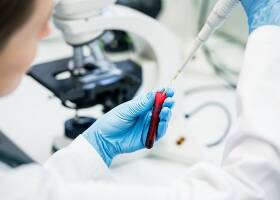 Местная власть Львова определилась со строительством крематория - rupor.info - Львов