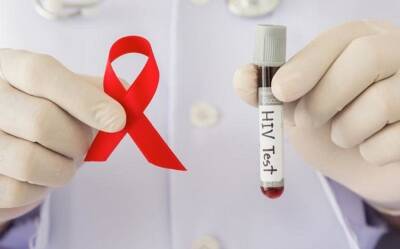В США успешно протестировали РНК-вакцину от ВИЧ - trend.az - США