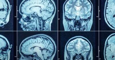 Ученые выяснили, что происходит с мозгом свидетелей НЛО - ren.tv