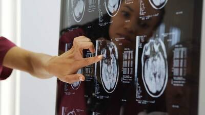 Ученые назвали причину снижения активности мозга и старения - iz.ru - Израиль