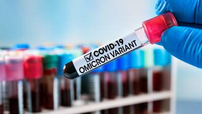 Виктор Ляшко - Первый случай «омикрона» зафиксирован на Украине и в Египте - mir24.tv - Украина - Египет - Эмираты