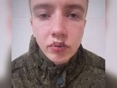 «У него просто крыша поехала»: в воинской части под Челябинском срочник зашил себе рот после ссоры с девушкой - bloknot.ru - Челябинская обл. - Челябинск