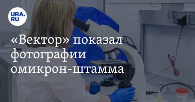 «Вектор» показал фотографии омикрон-штамма - ura.news