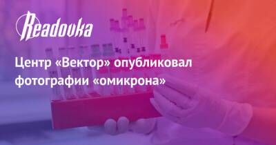 Центр «Вектор» опубликовал фотографии «омикрона» - readovka.ru - Египет
