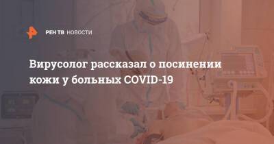 Максим Скулачев - Вирусолог рассказал о посинении кожи у больных COVID-19 - ren.tv