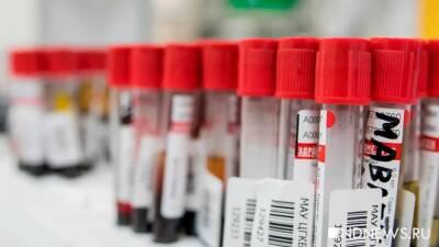 Жительницу Узбекистана посадят в тюрьму за заражение ВИЧ более 40 мужчин - newdaynews.ru - Узбекистан - Ташкент - Бухарская обл.