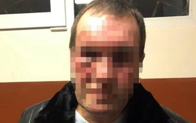 В Киеве мужчине прострелили ногу из-за некачественного ремонта - korrespondent.net - Украина - Киев
