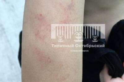 Воспитателя обвинили в избиении ребенка в детсаду Новосибирска - tayga.info - Россия - Новосибирск - Новосибирская обл. - район Октябрьский, Новосибирск