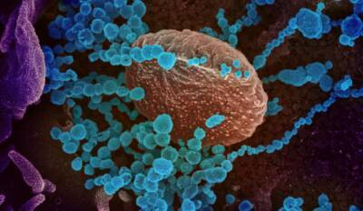 Израильские ученые научились уничтожать коронавирус за 2 секунды с помощью миллиметровых радиоволн - rusjev.net - Израиль - Иерусалим