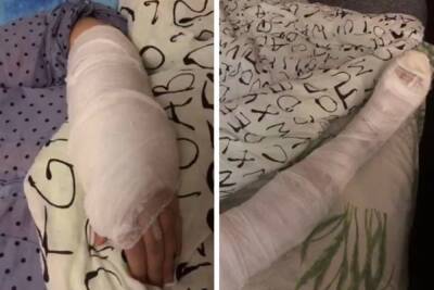 Ну Урале женщина получила перелом руки в травмпункте, куда приехала со сломанной ногой - znak.com - Екатеринбург