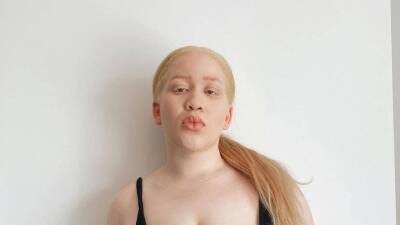 Афробританка родилась альбиноской — теперь она популярная модель plus size - skuke.net