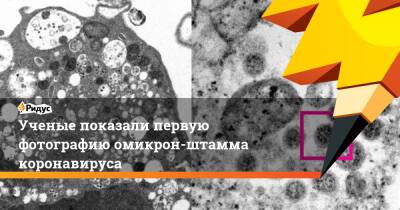 Ученые показали первую фотографию омикрон-штамма коронавируса - ridus.ru - Гонконг
