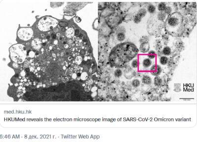 Ученые Гонконга опубликовали первый микроснимок омикрон-штамма COVID-19 - province.ru - Гонконг - Гонконг - Юар