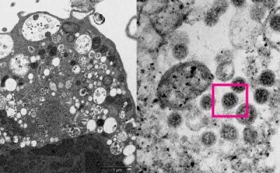 Ученые опубликовали фотографии вируса «Омикрон» - skuke.net - Гонконг - Гонконг - Юар - Ботсвана - Интересно