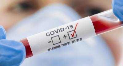 В Украине обнаружено 3409 новых случаев COVID-19: данные по регионам - vchaspik.ua - Киев