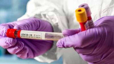 Венгрия будет выдавать сертификаты больным COVID-19 - lenta.ua - Венгрия