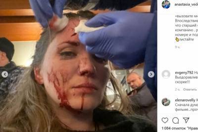 Анастасия Веденская - Экс-супруга актера Епифанцева показала фото лица после драки в Петербурге - abnews.ru - Москва - Санкт-Петербург