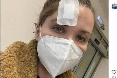 Владимир Епифанцев - Экс-жена Епифанцева выложила фото изуродованного лица после драки - mk.ru - Санкт-Петербург