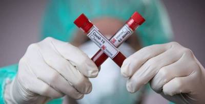 В США объяснили, почему происходит снижение числа новых случаев инфицирования коронавирусом - ТЕЛЕГРАФ - telegraf.com.ua - США