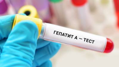 Вспышка гепатита в Одесской области: в лабцентре МЗ предположили, что дети могли заразиться во время отдыха в Египте - ru.espreso.tv - Египет - Одесса - Одесская обл.