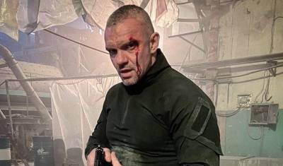 Режиссер Мусаев попал в больницу после драки с Епифанцевым - newizv.ru