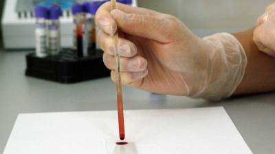 Маргарита Провоторова - Эпидемиолог перечислила анализы, которые нужно сдать переболевшим коронавирусом - nation-news.ru