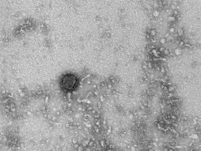 В США выявлен гибрид британского и американского штаммов коронавируса - nakanune.ru - США - Англия - Бразилия - Юар - штат Нью-Мексико