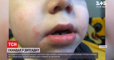 Не клеила, а пугала: воспитательница детсада уверяет, что скотч к детям не применяла - tsn.ua