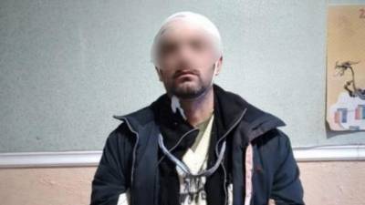 Сергей Шайхет - Полиция задержала поджигателя «Эпицентра» в Первомайске - hubs.ua - Николаевская обл. - Первомайск