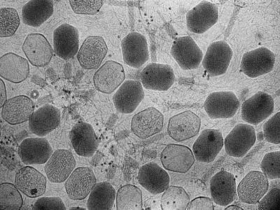 На бактериях из кишечника человека паразитируют более 140 тысяч видов бактериофагов - polit.ru