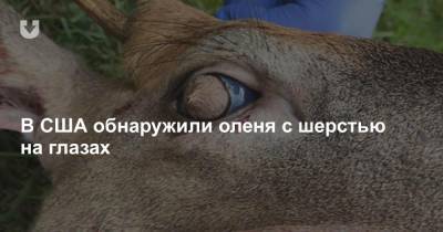 В США обнаружили оленя с шерстью на глазах - news.tut.by - США - штат Теннесси