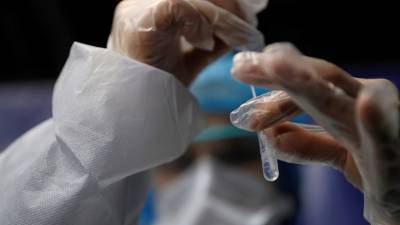 Во Франции - Во Франции за сутки выявили более 22 тысяч случаев коронавируса - russian.rt.com - Santé